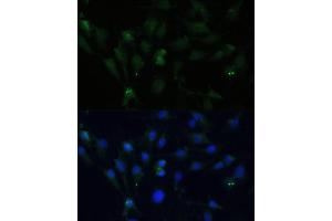 Immunofluorescence analysis of C6 cells using ZWINT Polyclonal Antibody (ABIN6128944, ABIN6150552, ABIN6150554 and ABIN6221938) at dilution of 1:100 (40x lens).