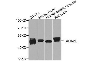 Western blot analysis of extracts of various cell lines, using TADA2A antibody. (TADA2L antibody  (AA 1-443))