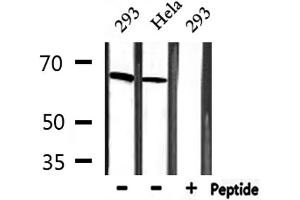Western blot analysis of extracts from 293 and Hela, using MBD1 Antibody. (MBD1 antibody  (C-Term))