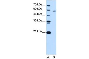 PKLR antibody used at 5 ug/ml to detect target protein. (PKLR antibody  (N-Term))