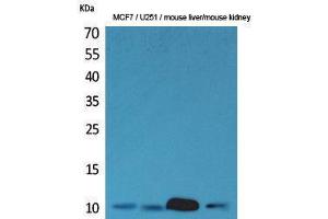 Western Blotting (WB) image for anti-Diazepam Binding Inhibitor (DBI) (C-Term) antibody (ABIN3187735) (Diazepam Binding Inhibitor antibody  (C-Term))