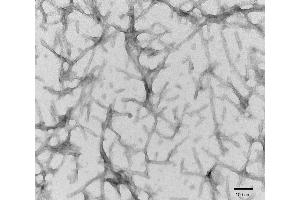 Electron Microscopy (EM) image for tau Protein (full length), (Pro301Ser-Mutant) (Active) protein (ABIN6929397)