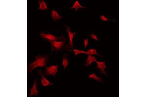 ABIN6274303 staining COLO205 by IF/ICC. (ST5 antibody  (Internal Region))