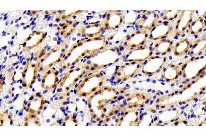 Immunohistochemistry (IHC) image for anti-Glutathione S-Transferase mu 1 (GSTM1) (AA 1-218) antibody (ABIN7436972)
