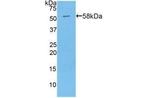 Detection of Recombinant PAPPA, Mouse using Polyclonal Antibody to Pregnancy Associated Plasma Protein A (PAPPA) (PAPPA antibody  (AA 999-1272))