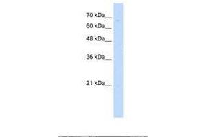 Image no. 1 for anti-Zinc Finger Protein 654 (ZNF654) (AA 31-80) antibody (ABIN6737713) (ZNF654 antibody  (AA 31-80))