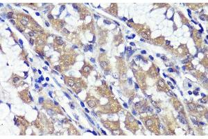 Immunohistochemistry of paraffin-embedded Human stomach using UBL3 Polyclonal Antibody at dilution of 1:100 (40x lens).