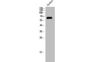 Western Blot analysis of Jurkat cells using CstF-64T Polyclonal Antibody (CSTF2T antibody  (Internal Region))