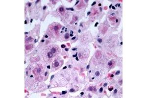 Immunohistochemical analysis of NDRG4 staining in human liver formalin fixed paraffin embedded tissue section.
