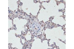 Immunohistochemistry of paraffin-embedded Rat lung using Phospho-Jak2(Y1007/1008) Polyclonal Antibody at dilution of 1:200 (40x lens).