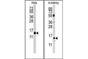 Image no. 1 for anti-Cytidine Deaminase (CDA) (AA 59-89) antibody (ABIN358053) (CDA antibody  (AA 59-89))