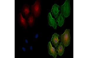 ABIN6258918 and ABIN6274669 staining  cells by IF/ICC. (GBP1 antibody  (C-Term))