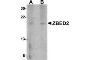 Western blot analysis of ZBED2 in A549 cell lysate with this product at (A) 1 and (B) 2 μg/ml. (ZBED2 antibody  (N-Term))