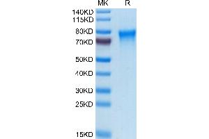 TREML2 Protein (AA 19-268) (His tag)