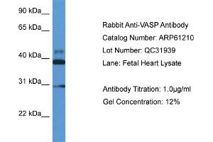 Western Blotting (WB) image for anti-Vasodilator-Stimulated phosphoprotein (VASP) (Middle Region) antibody (ABIN2774308) (VASP antibody  (Middle Region))