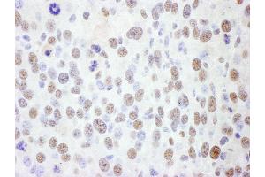 Immunohistochemistry (IHC) image for anti-Structural Maintenance of Chromosomes 1A (SMC1A) (AA 1183-1233) antibody (ABIN7454968)