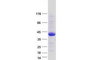 Transmembrane Protein 169 (TMEM169) (Transcript Variant 2) protein (Myc-DYKDDDDK Tag)