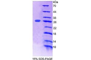 SDS-PAGE analysis of Mouse POMT1 Protein. (POMT1 Protein)