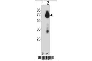 Western blot analysis of BIRC3 using rabbit polyclonal BIRC3 Antibody using 293 cell lysates (2 ug/lane) either nontransfected (Lane 1) or transiently transfected (Lane 2) with the BIRC3 gene. (BIRC3 antibody  (N-Term))