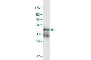 Western Blot detection against Immunogen (37. (PRKAR2A antibody  (AA 1-105))