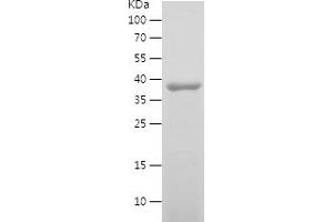 Western Blotting (WB) image for Neurotrophic Tyrosine Kinase, Receptor, Type 2 (NTRK2) (AA 32-205) protein (His-IF2DI Tag) (ABIN7282946) (TRKB Protein (AA 32-205) (His-IF2DI Tag))
