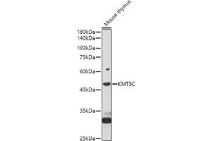 Western blot analysis of extracts of Mouse thymus, using KMT5C antibody (ABIN7270649) at 1:1000 dilution. (SUV420H2/KMT5C antibody  (AA 100-200))
