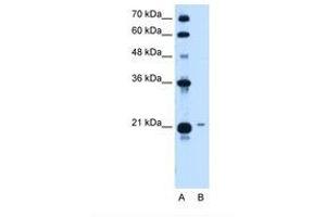 Image no. 2 for anti-T-Complex 10 (TCP10) (AA 109-158) antibody (ABIN321002) (TCP10 antibody  (AA 109-158))