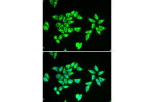 Immunofluorescence analysis of MCF-7 cells using PTRH2 antibody (ABIN5973864).
