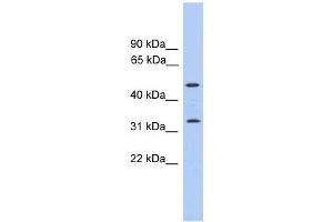 Western Blot showing FAM79B antibody used at a concentration of 1-2 ug/ml to detect its target protein. (TPRG1 antibody  (C-Term))