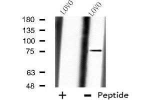 Western blot analysis of extracts from LOVO cells, using CAPN10 antibody.