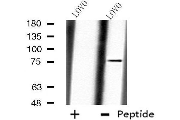 CAPN10 antibody  (N-Term)