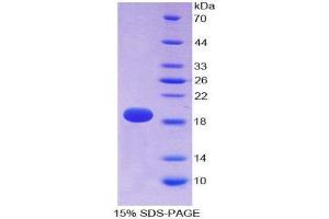 SDS-PAGE (SDS) image for Spectrin alpha Chain, Brain (SPTAN1) (AA 1571-1712) protein (His tag) (ABIN1878410) (SPTAN1 Protein (AA 1571-1712) (His tag))