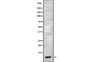 Western blot analysis of CCK using NIH-3T3 whole cell lysates (Cholecystokinin antibody  (Internal Region))
