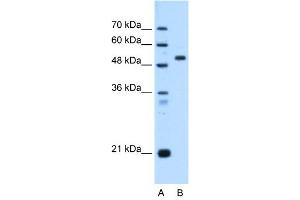 ST14 antibody used at 0. (ST14 antibody)