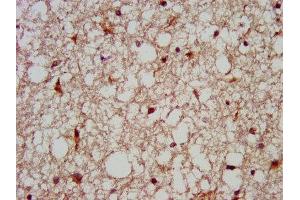 IHC image of ABIN7159209 diluted at 1:200 and staining in paraffin-embedded human brain tissue performed on a Leica BondTM system. (MC3R antibody  (AA 38-74))