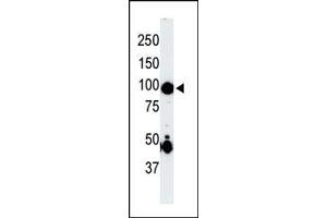 The anti-P4K2 Pab (ABIN391081 and ABIN2841226) is used in Western blot to detect P4K2 in mouse skeletal muscle tissue lysate. (MAP4K2 antibody  (AA 288-319))