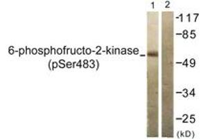 Western blot analysis of extracts from 293 cells treated with Heat shock, using PFKFB2 (Phospho-Ser483) Antibody. (PFKFB2 antibody  (pSer483))