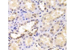 Immunohistochemistry of paraffin-embedded Human kidney using PSMC6 Polyclonal Antibody at dilution of 1:100 (40x lens). (PSMC6 antibody)
