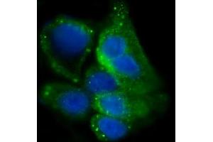IF analysis of Glycogen synthase 1/GYS1 using anti-Glycogen synthase 1/GYS1 antibody (ABIN7602155). (Glycogen Synthase 1 antibody  (AA 60-640))