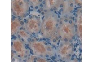 Figure. (HSD11B2 antibody  (AA 58-393))