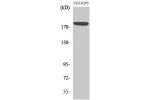 Western Blotting (WB) image for anti-MAP-Kinase Activating Death Domain (MADD) (Internal Region) antibody (ABIN3180153) (MADD antibody  (Internal Region))