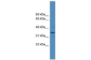 WB Suggested Anti-SNRPA  Antibody Titration: 0. (SNRPA1 antibody  (N-Term))