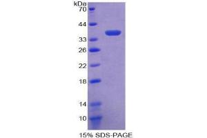 SDS-PAGE (SDS) image for Protein tyrosine Phosphatase, Receptor Type, S (PTPRS) (AA 77-361) protein (His tag) (ABIN2126556)