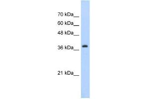 WB Suggested Anti-CBX6 Antibody Titration:  5. (CBX6 antibody  (C-Term))