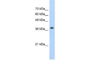 WB Suggested Anti-CBX6 Antibody Titration:  5.