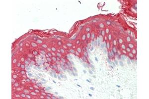 Anti-KRT10 / CK10 / Cytokeratin 10 antibody IHC staining of human skin. (Keratin 10 antibody  (AA 150-179))