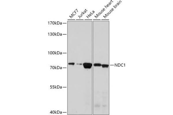 TMEM48 Antikörper  (AA 340-530)