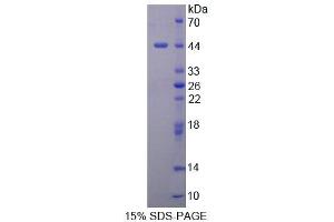SDS-PAGE (SDS) image for Deoxyhypusine Synthase (DHPS) (AA 1-369) protein (His tag) (ABIN4989615)