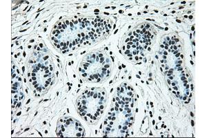 Immunohistochemical staining of paraffin-embedded breast tissue using anti-BRAF mouse monoclonal antibody. (BRAF antibody)