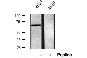 SQLE antibody  (C-Term)